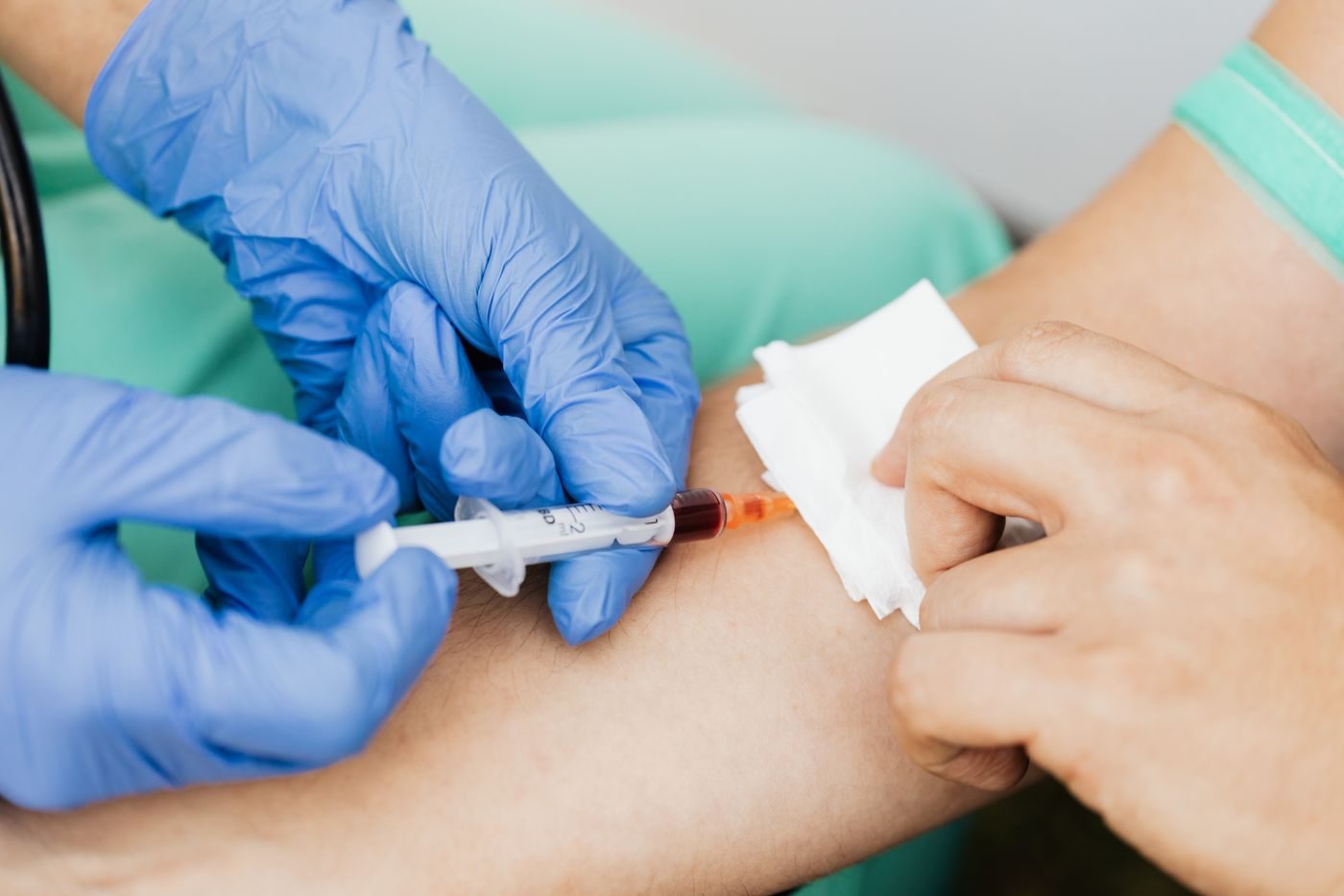 Toma de muestra de sangre del brazo con banda y guantes, en el laboratorio